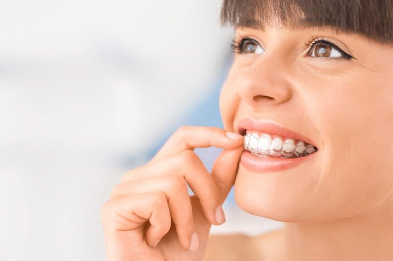 Why Invisalign in Selkirk Is Becoming the Preferred Choice for Teen Orthodontics