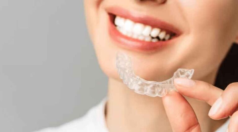 Get a Straighter Smile Without the Wait: Clear Aligners Explained